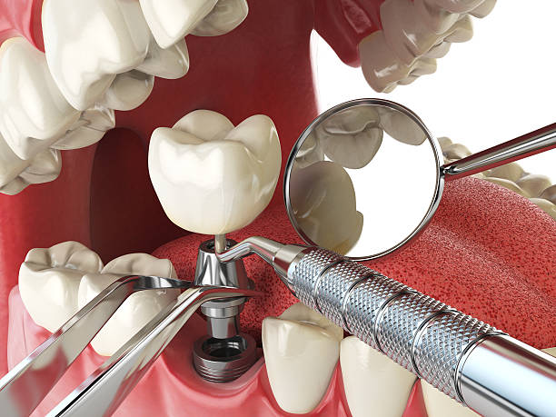 Best Urgent Tooth Repair  in Box Elder, SD